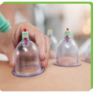 cupping therapy de taille 3